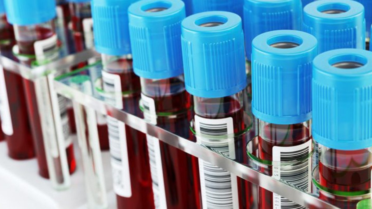 Kalsiyum (Ca) testi nedir?