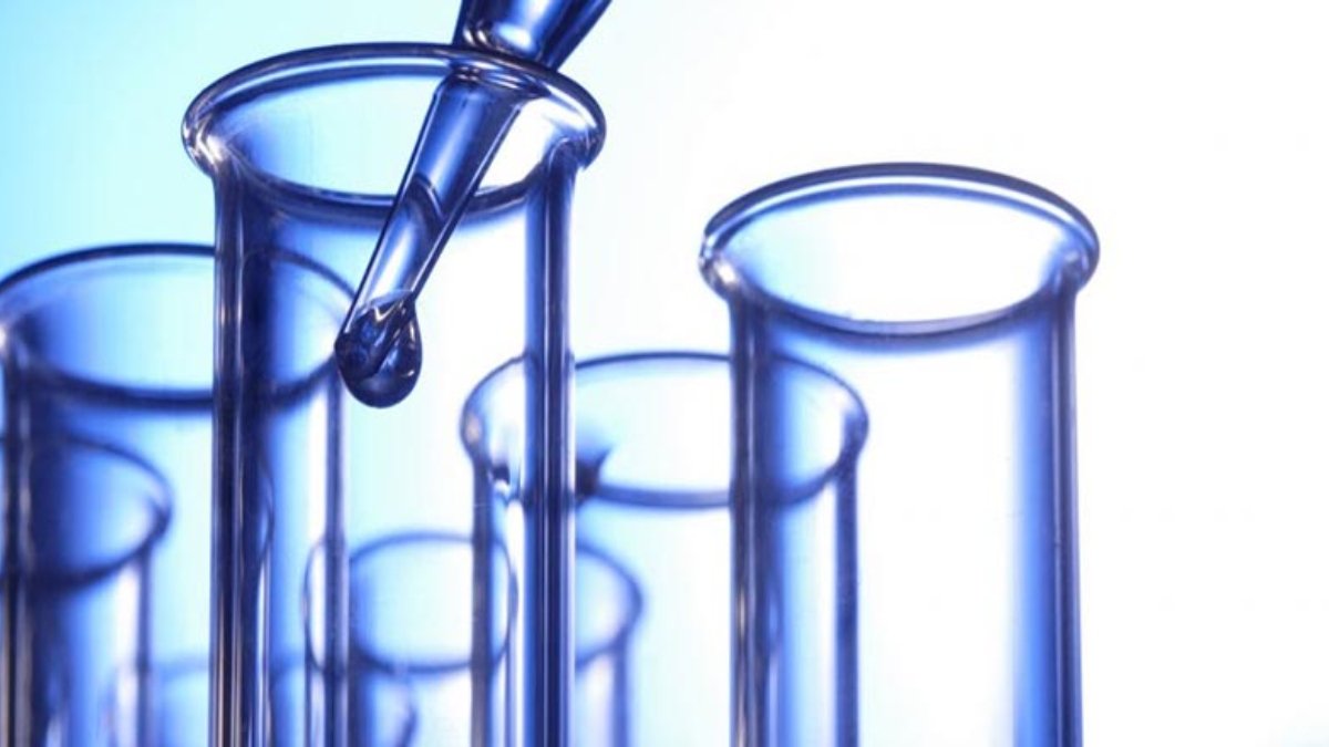 Karbamazepin testi nedir?