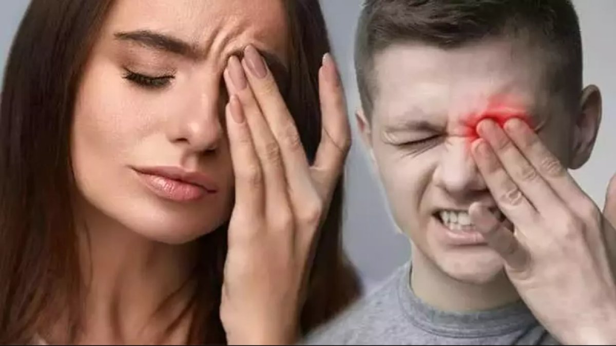 Göz Batmasına Ne İyi Gelir?