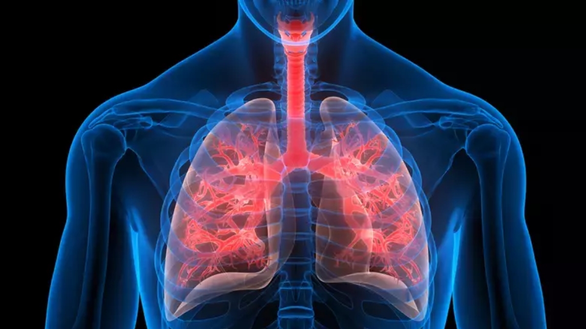 Kronik obstrüktif akciğer hastalıkları (Koah) hakkında bilgiler