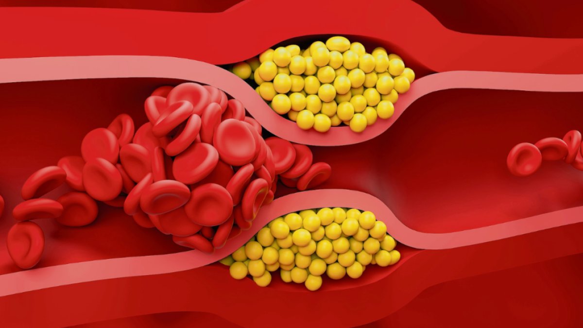 HDL Kolesterol Nedir?