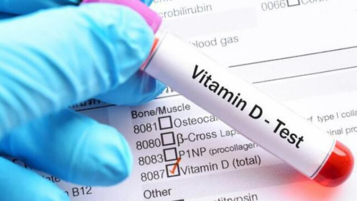 Hidroksi Vitamin D Nedir?