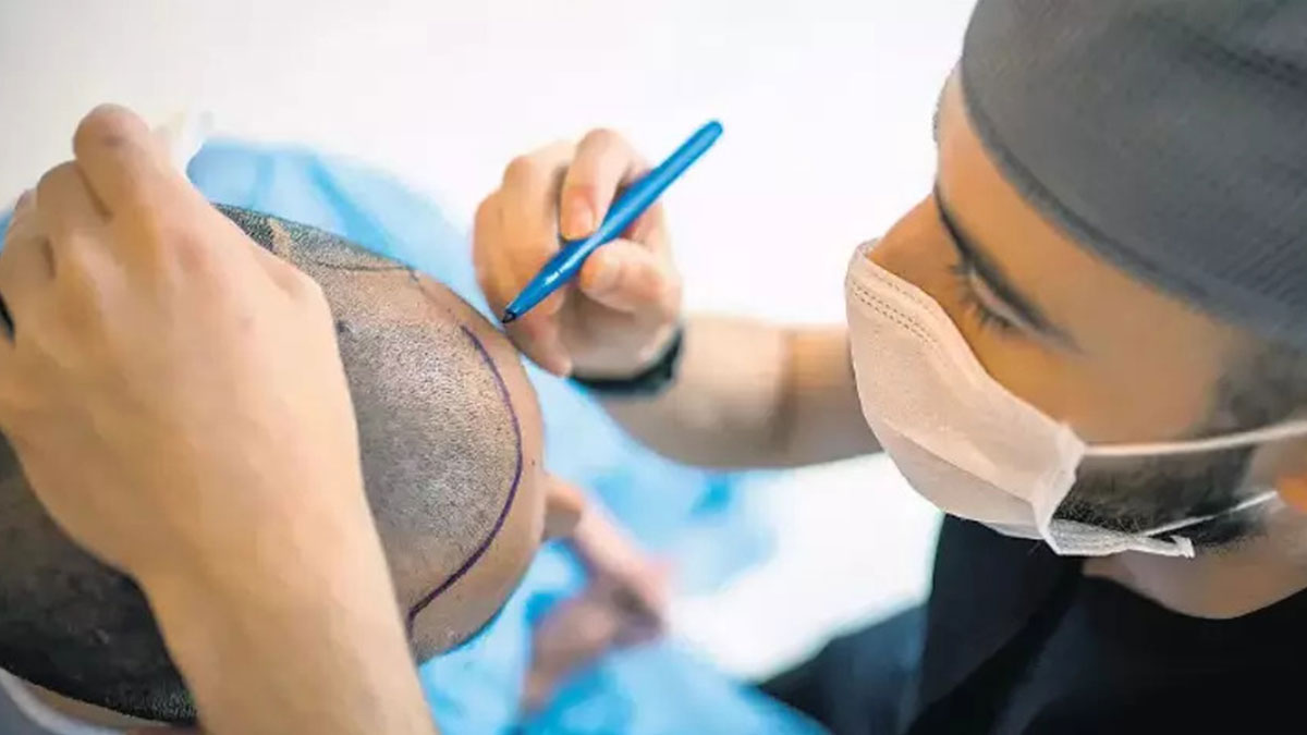 Saç ekimi başarısız olanlar dikkat: Mahkeme öyle bir karar verdi ki klinik sahipleri şimdi yandı! Emsal niteliğinde olacak