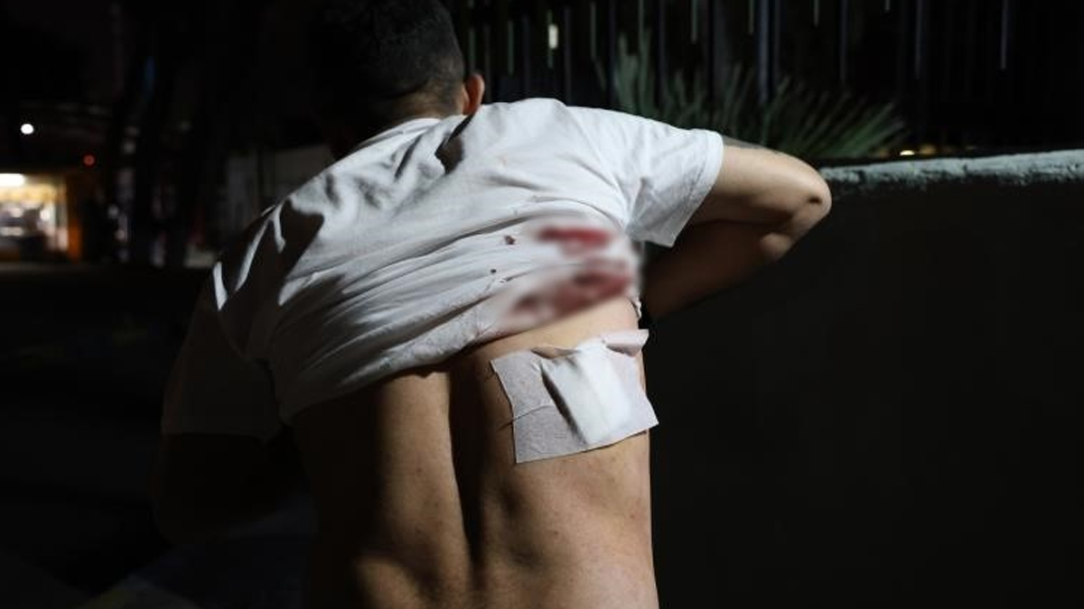 'Aracımı kapattım' diyen taksiciyi makasla yaraladı