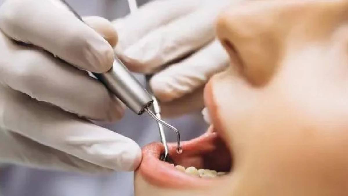 Diş dolgusu yaptıran dikkat! Büyük tehlikesi ortaya çıktı: Beyin, sinirler ve böbrek hasarına yol açıyor: O ülkelerde yasaklandı