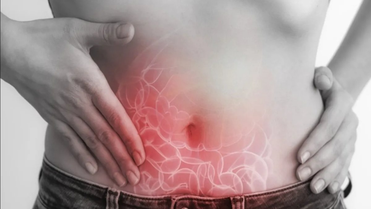 Kadınlarda Apandisit Belirtileri