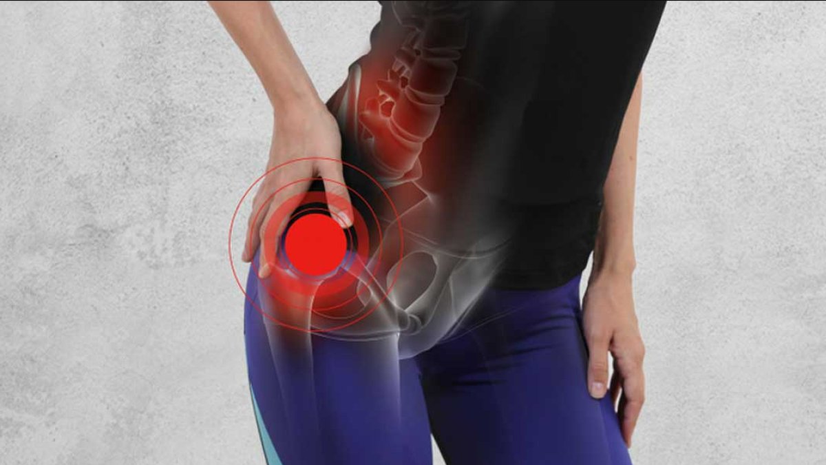 Kalça Ağrısı: Nedenleri ve Çözüm Yolları