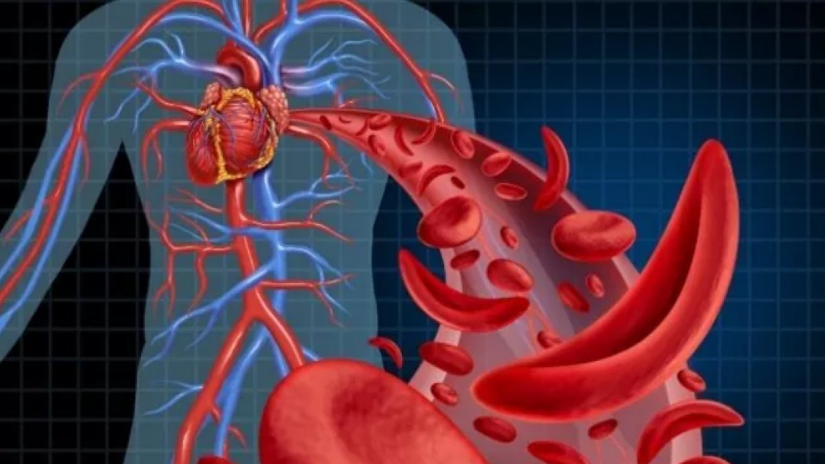 Kalp Damar Tıkanıklığı Belirtileri