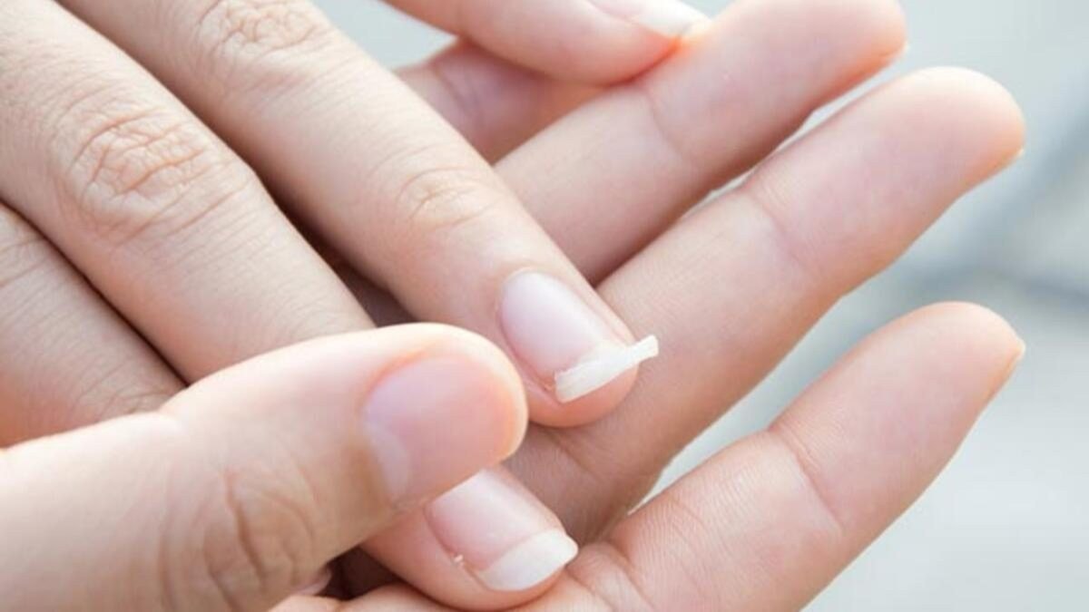 Bir tırnağınız kırıldı diye hepsini kesmeyin! Bu yöntemle kırılan tırnağınızı onarabilirsiniz: 5 dakikada kırılan tırnak onarımı