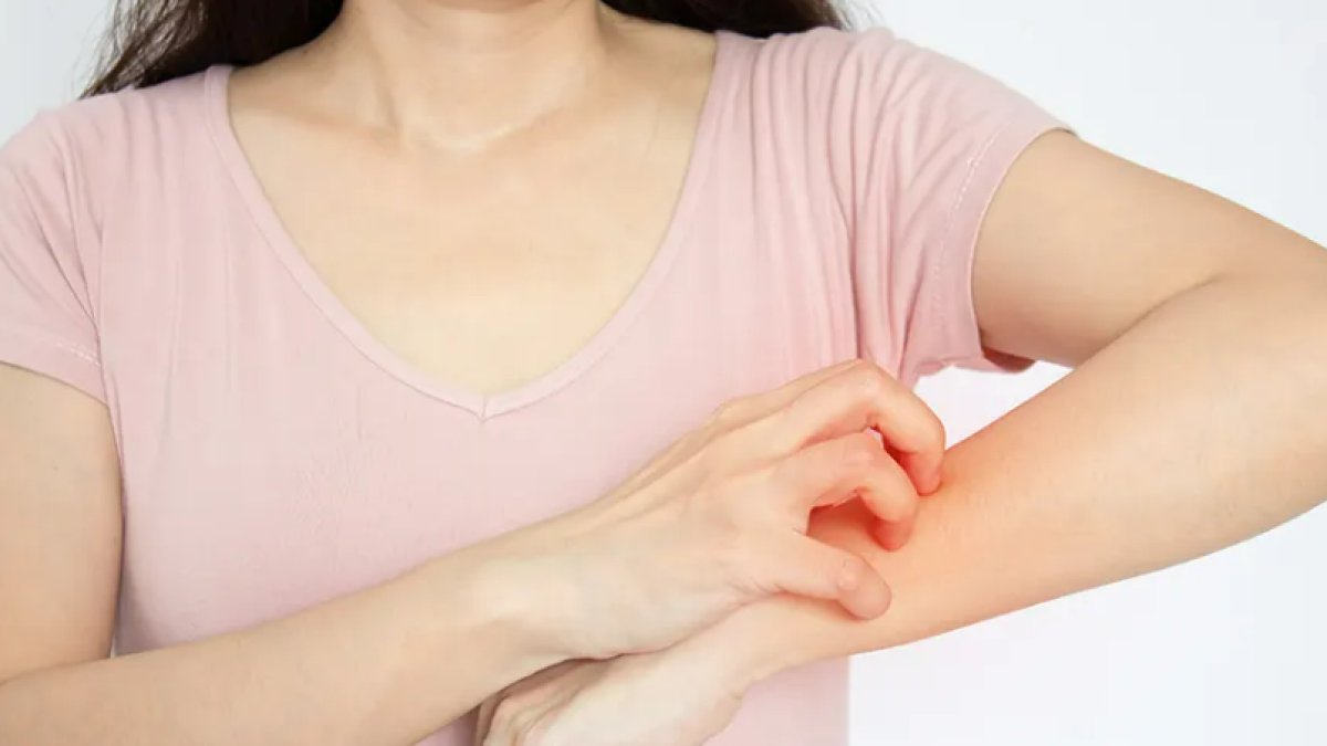 Kaşıntı Nasıl Geçer: Rahatlatıcı Yöntemler ve İpuçları