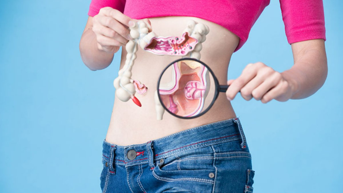 Kolon Kanseri Belirtileri, Tanısı ve Tedavisi