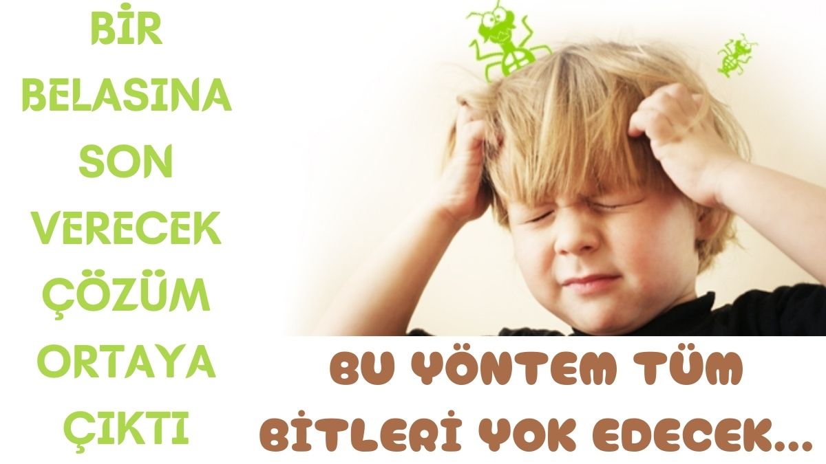 Bit geçen çocuklara doğal çözüm! Suyla karıştırıp saça sürün ne sirke bırakıyor ne bit