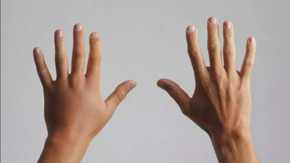 Ödeme Ne İyi Gelir? Vücuttaki Şişkinliği Atma Yöntemleri