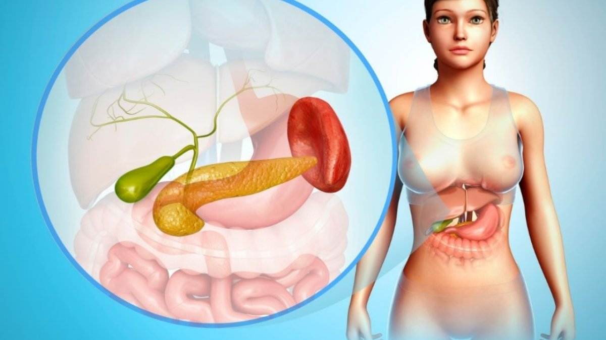 Pankreas Kanseri Belirtileri