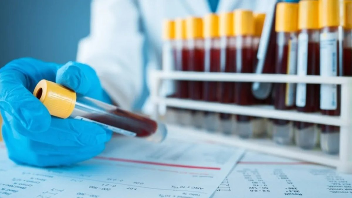 PDW Nedir? Kan Tahlili