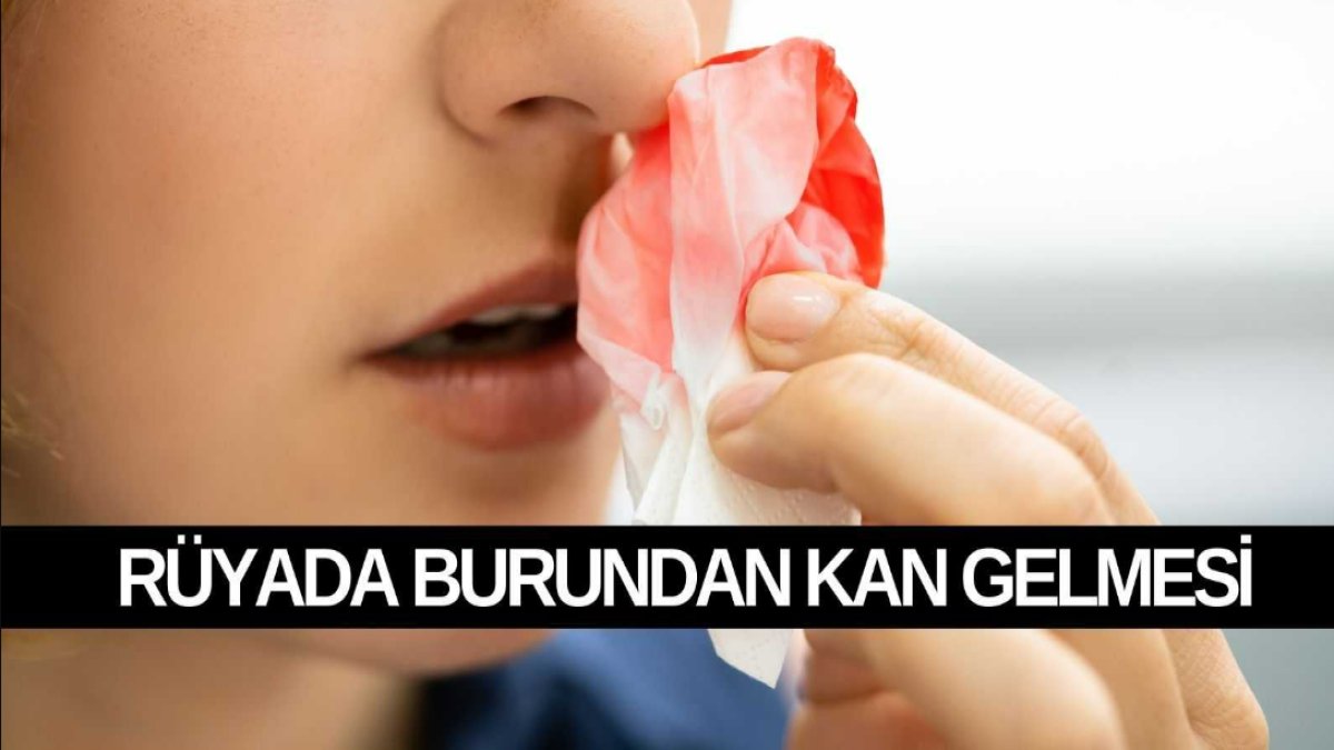 Rüyada Burun Kanaması: Anlamlar, İnançlar ve Gerçeklik Arasındaki İlişki