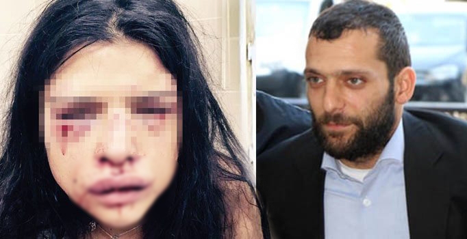 Özbizerdik serbest kalır 
kalmaz sevgilisini dövdü