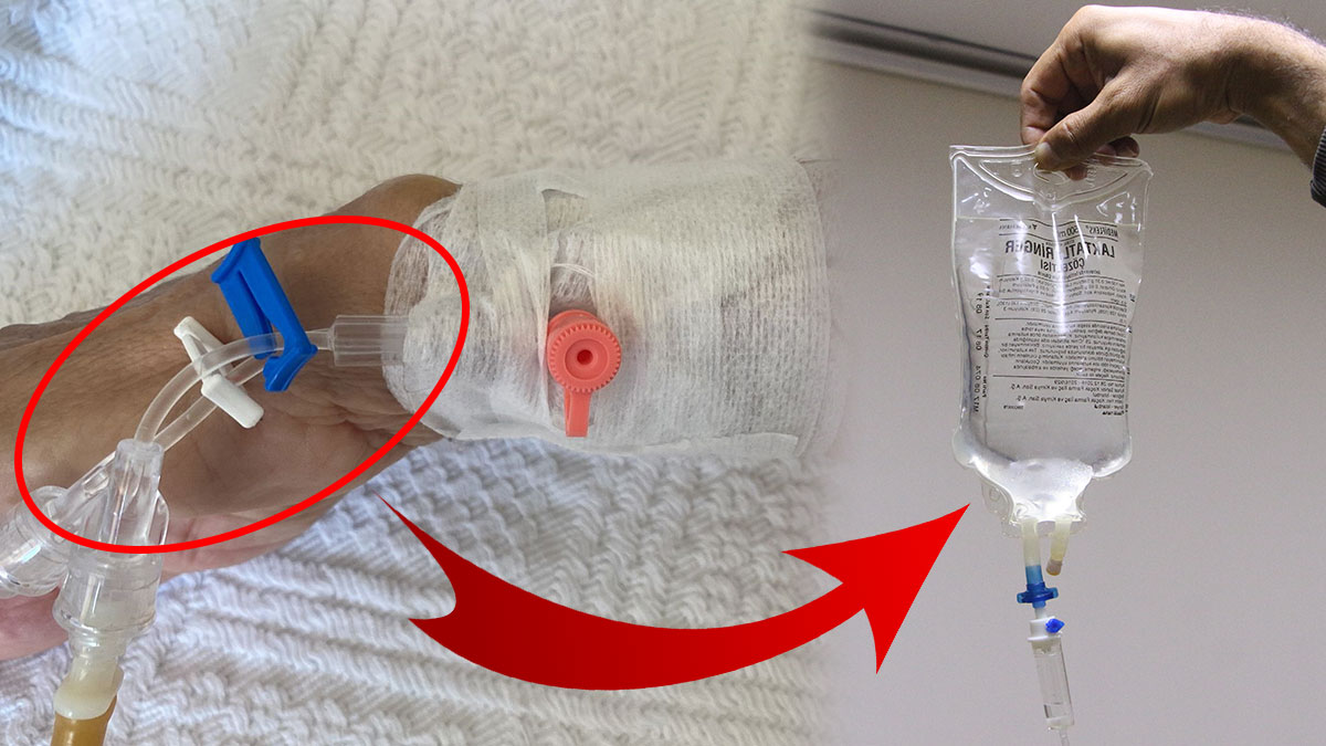 Plastik serumlar meğer kalp krizi riskini artırıyormuş! Bilim insanlarından korkutan rapor