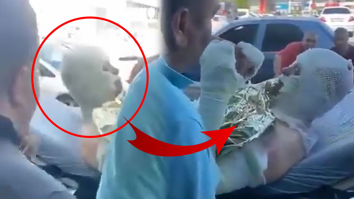 Alevlerin arasında kalarak yaralanan adamın sedyedeki hareketi şoke etti! Hiç kimse bunu beklemiyordu