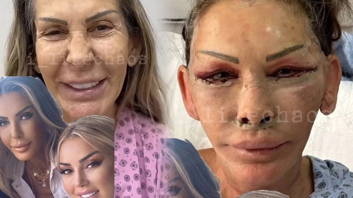 Estetik yaptıran Petek Dinçöz'ün annesine herkes aynı yorumu yaptı! Sosyal medyada viral oldu