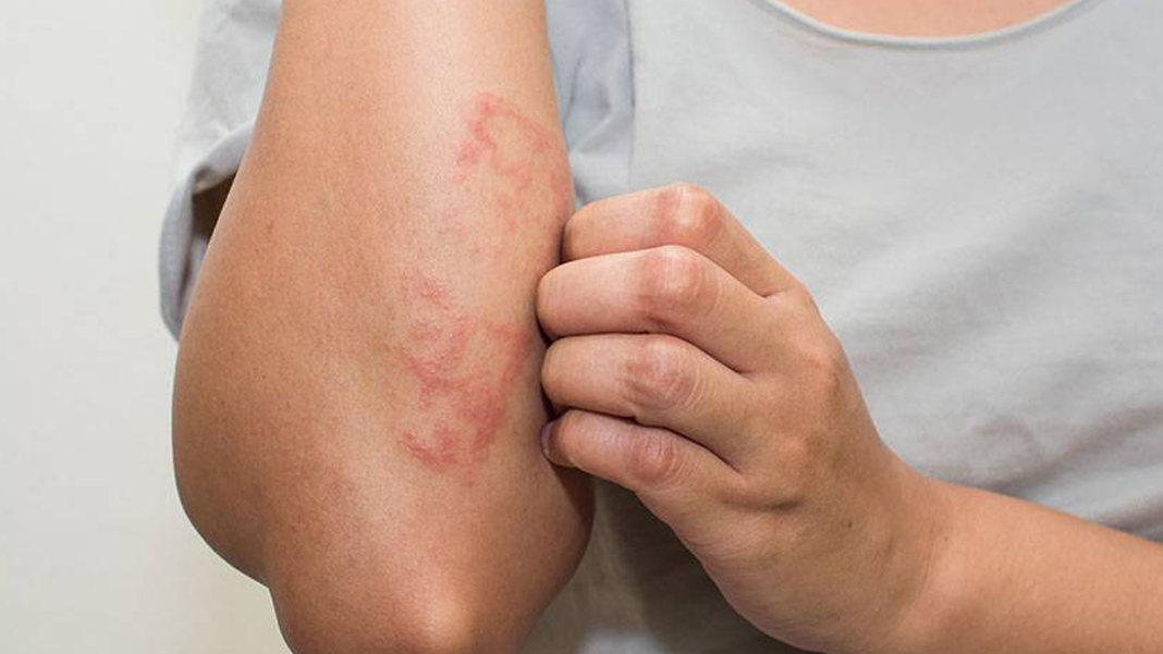 Bu belirtiler vücudunuzda kanserli hücre olduğuna işaret edebilir! Vücutta iyileşmeyen yaralara dikkat