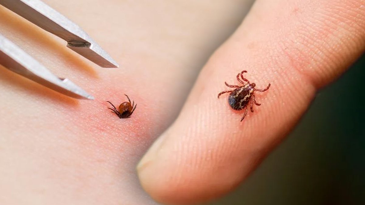 Uzmanı 'asıl tehlike fark edilmiyor' diyerek uyardı: Güneş çarpması değil, kene ısırığı!