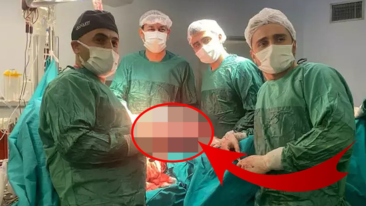 Meğer yıllarca karnında dev kitleyle yaşamış! 'Gebe bir kadın gibiydim' sözleri güldürdü