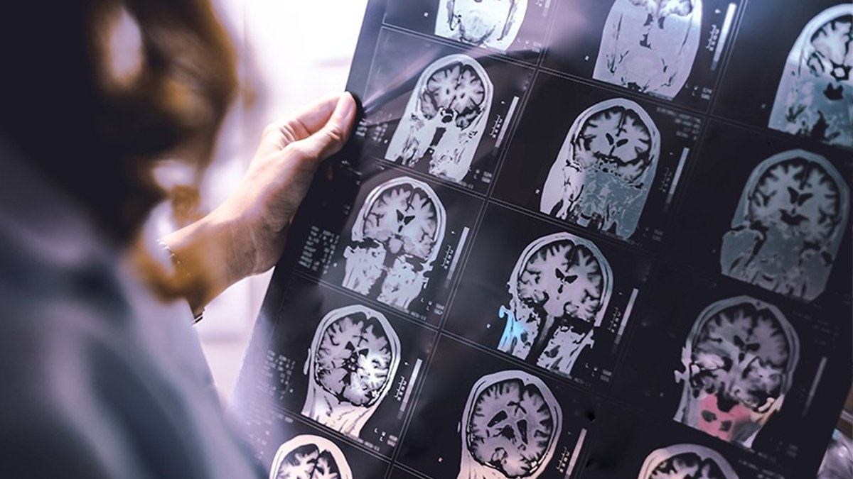 Bilim insanlarından çığır açacak keşif: Dondurulmuş insanlar hayata dönebilecek