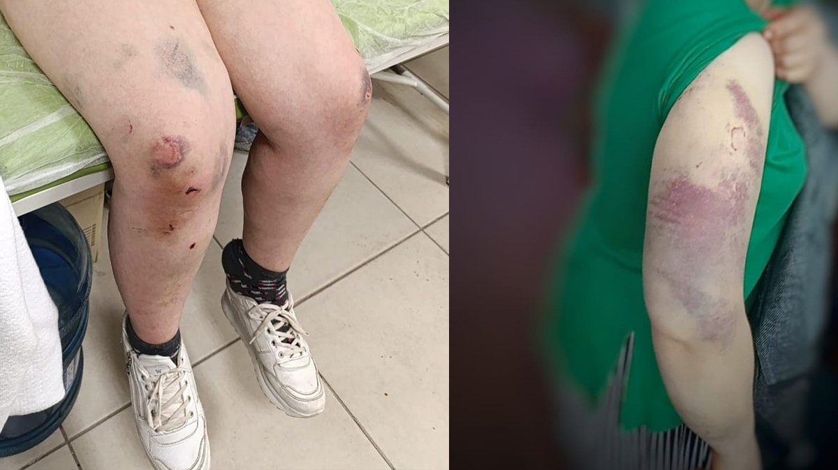 Eşinden kaçan kadın yaşadığı dehşeti anlattı: 9 yıldır eziyet görüyorum...