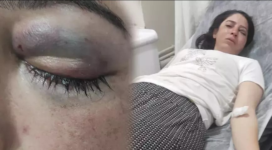 Kadına şiddet engellenemiyor! Evde kocası, evi terk edince kardeşi dövdü!