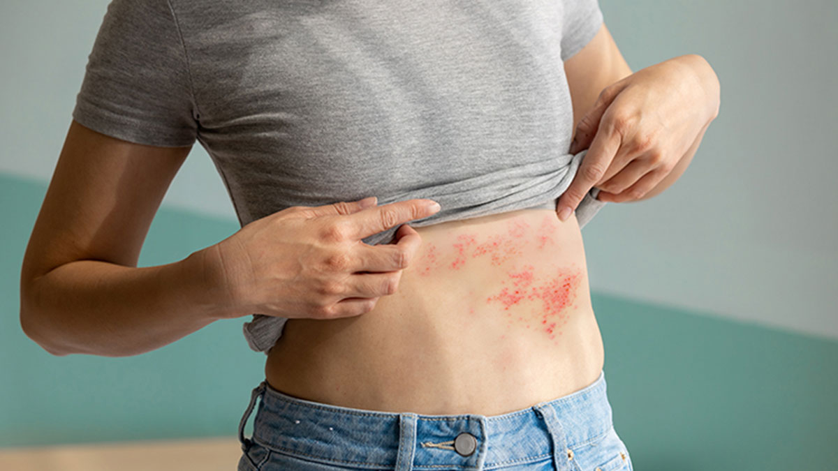 Halk arasında 'gece yanığı' olarak biliniyor: Bu hastalığın tam tedavisi yok! İleri yaştakileri hedef alıyor