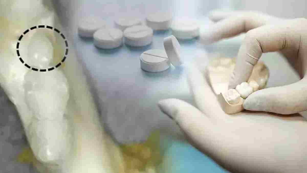Dişlerde implant bitiyor, yerine bu geliyor! Dişleri yeniden çıkaran ilaçta test başladı, dişsizlik tarih oluyor