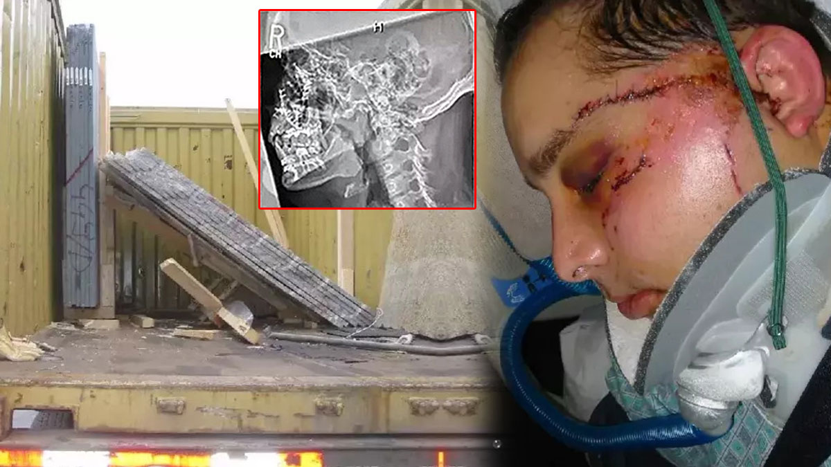 Kaza sonucu gözleri yerinden çıktı, kafatasının içi görünüyordu! 6 dakika ölü kaldı, yaşam savaşını kazandı