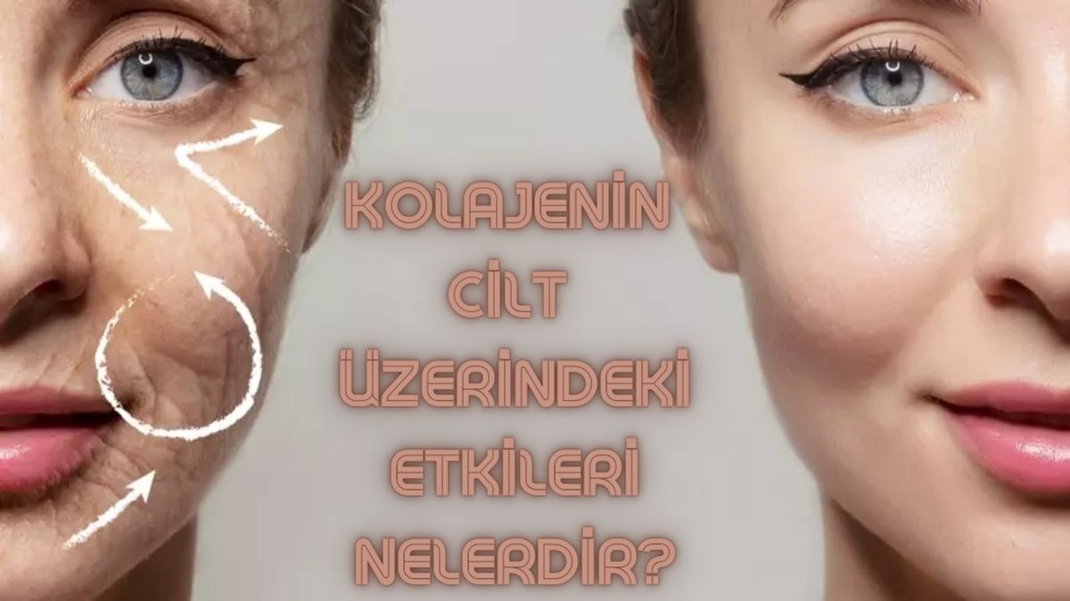 Cilt için kolajenin faydaları neler?