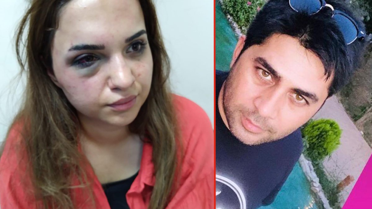 Bir yıldır boşanmak isteyen eşini darbedip, bıçakladı: Arkam sağlam bana ne polis ne savcı bir şey yapamaz