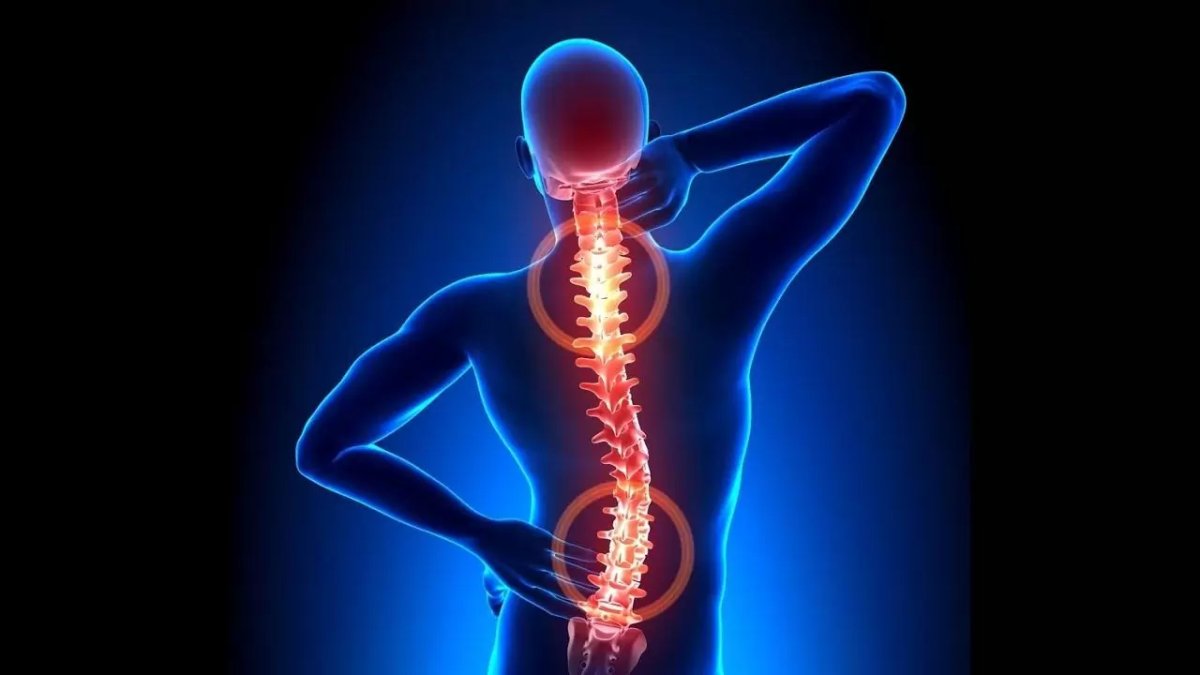 Bel fıtığınız varsa bu 2 egzersizle fıtığınızdan kurtulun! Ünlü fizyoterapist Arafat Aydemir müthiş sırrını açıkladı