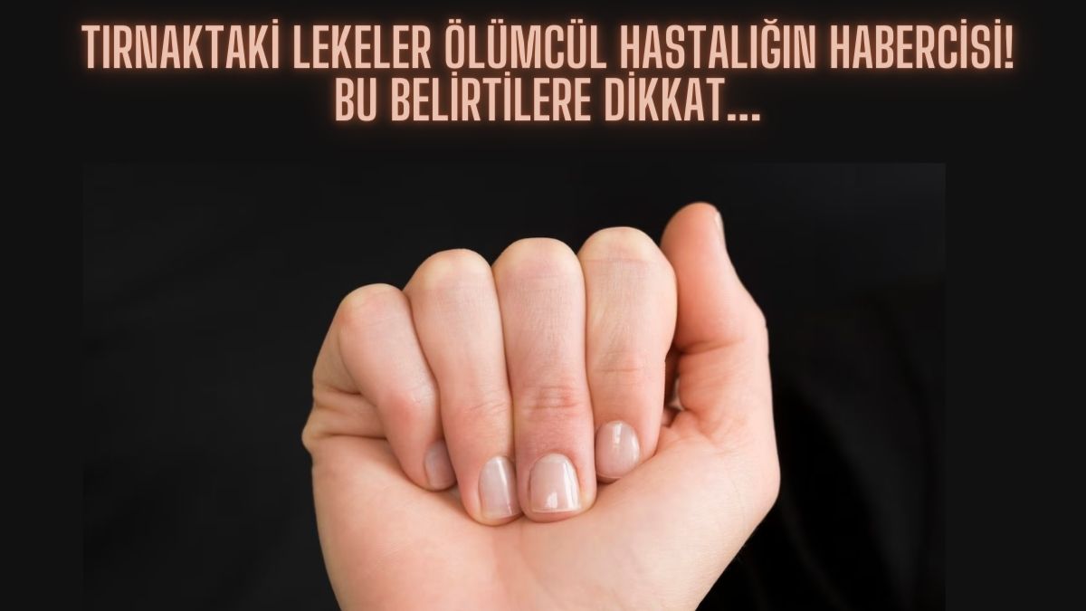 Tırnaktaki bu lekeler ölümcül hastalığın habercisi! Uzman isim ‘kanser’ diyerek uyardı: Bu belirtilere dikkat edin