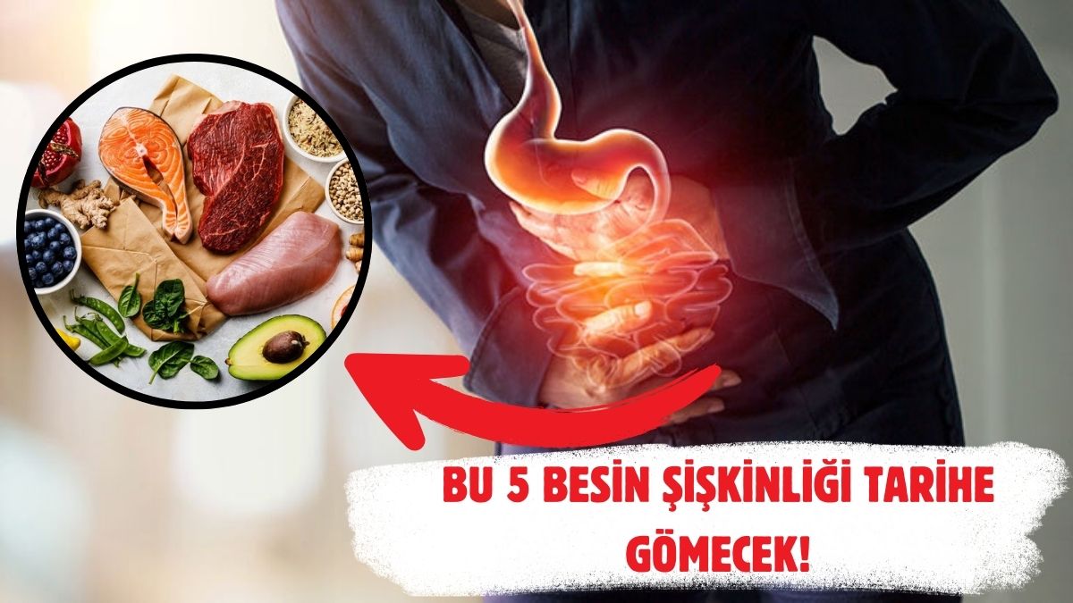 Şişkinlik sorunu tarihe karışıyor! Bu 5 besin hem kurtaracak hem önleyecek: Şimdiye kadar neden denemedim diyeceksiniz