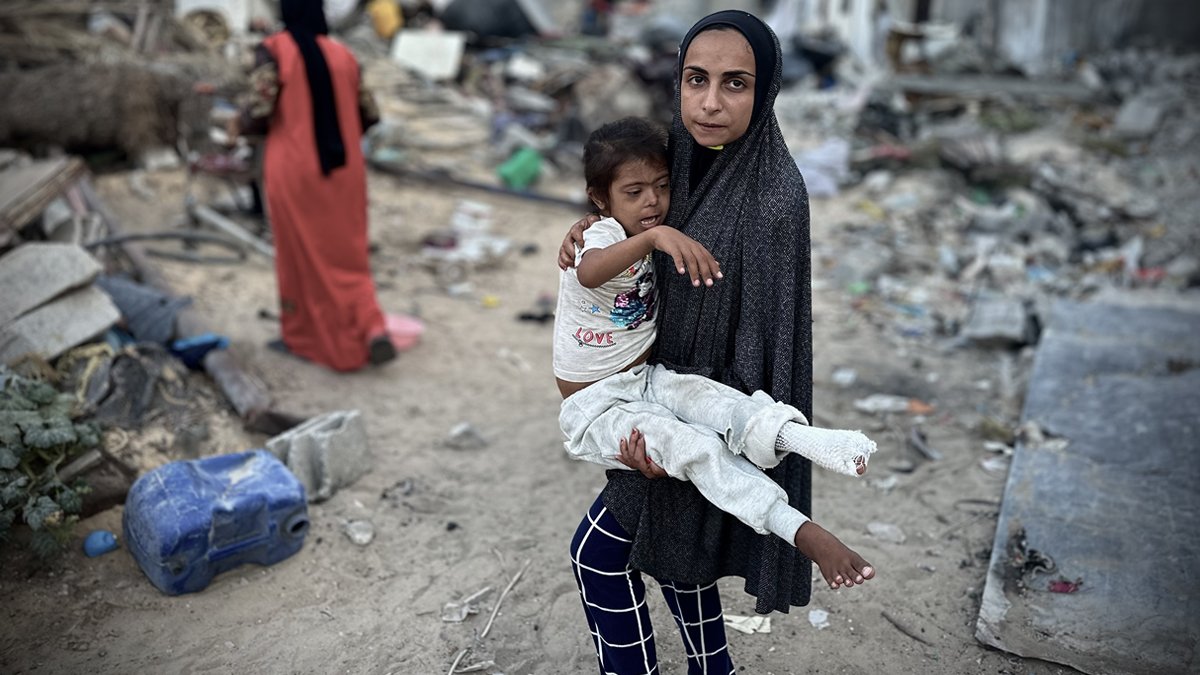 Gazze'de çaresizlik de öldürüyor: Tarihi geçmiş yiyecek yemek zorunda kalınca zehirlendiler