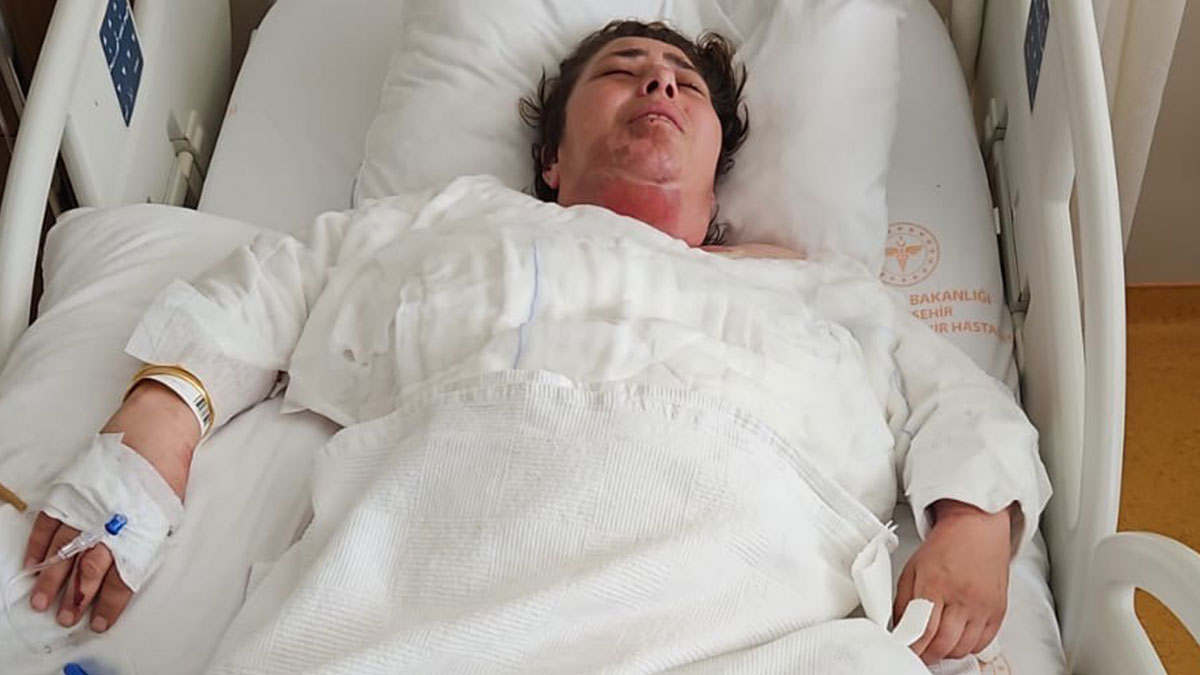 Bomba gibi patladı: Vücudunun yüzde 40'ı, yüzünün tamamı yandı! Hemen her evde var, nedensiz patlayabiliyor