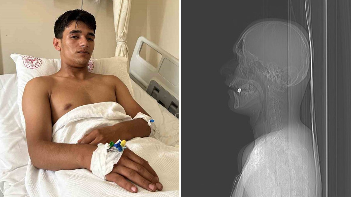 Pendik'te maganda dehşeti: Boynundan giren kurşun ağzında kaldı