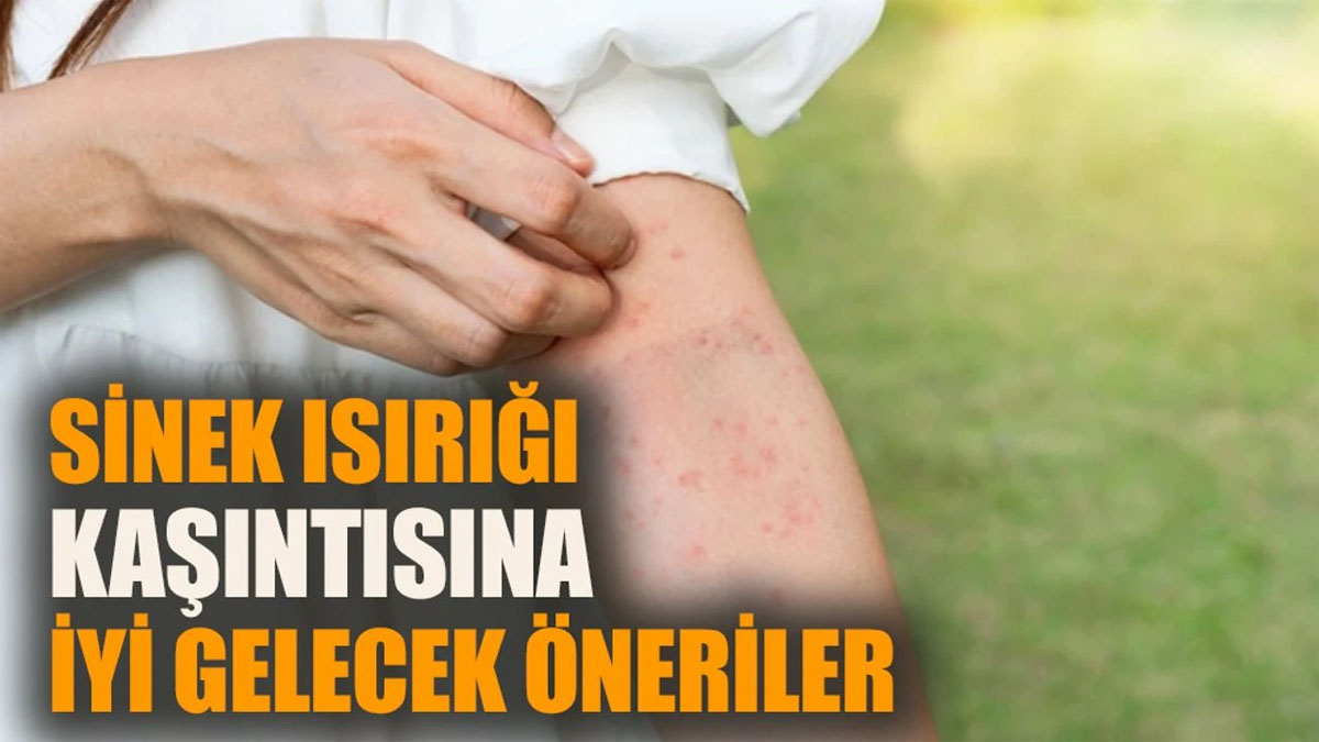 Sinek ısırığının reçetesi evdeymiş! Sadece üzerine sürün, kaşıntı ve kızarıklıktan eser bırakmıyor