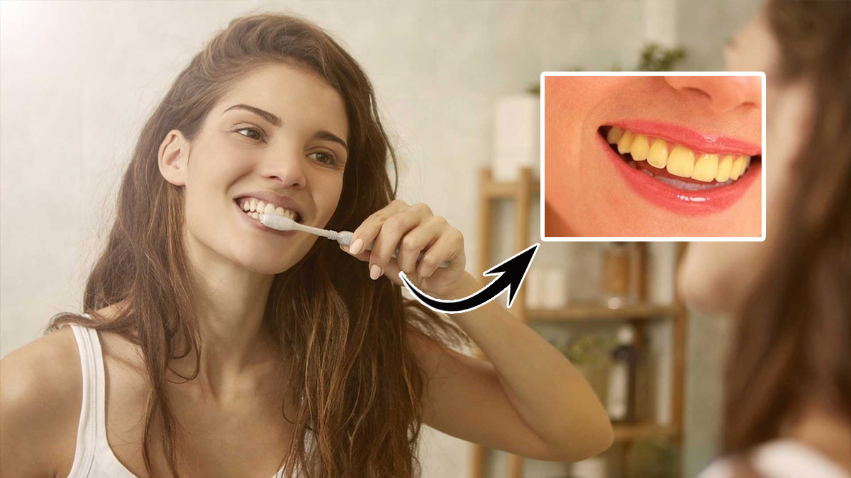 Bu tarif dişlerinizi inci gibi yapacak! Diş macununa para vermeyin: İşte dişleri beyazlatmanın sırrı...