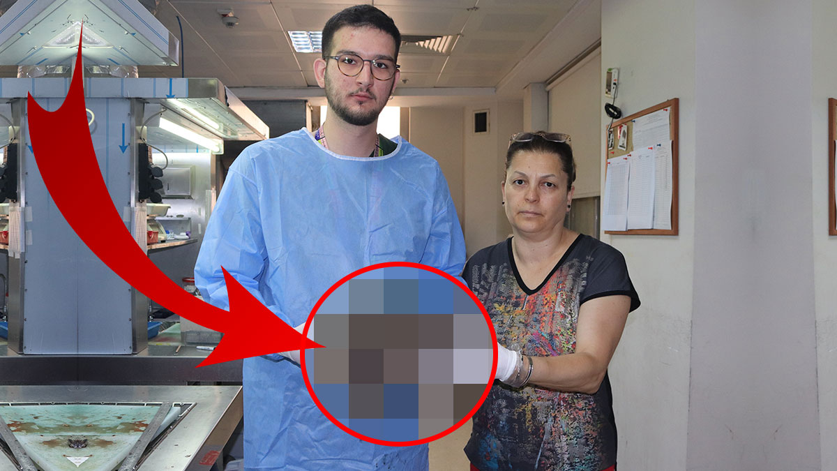 'Karnım ağrıyor' dedi, midesinden çıkanları görünce şoka girdi! İki kişi zor taşıdı