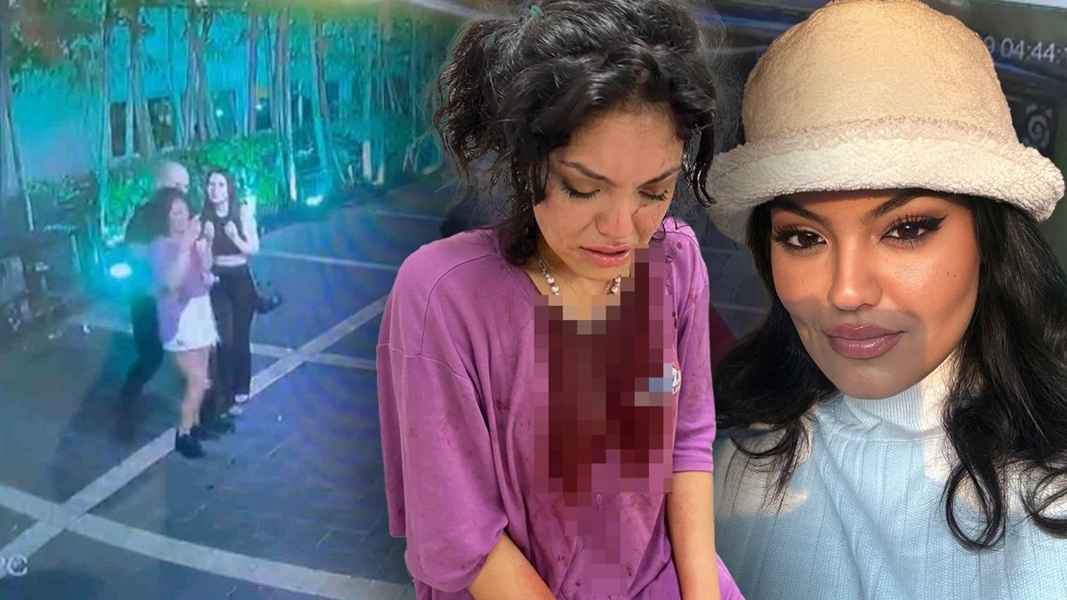 Fenomene öldüresiye darp! 'Kafama çakı soktular, beni merdivenden attılar'