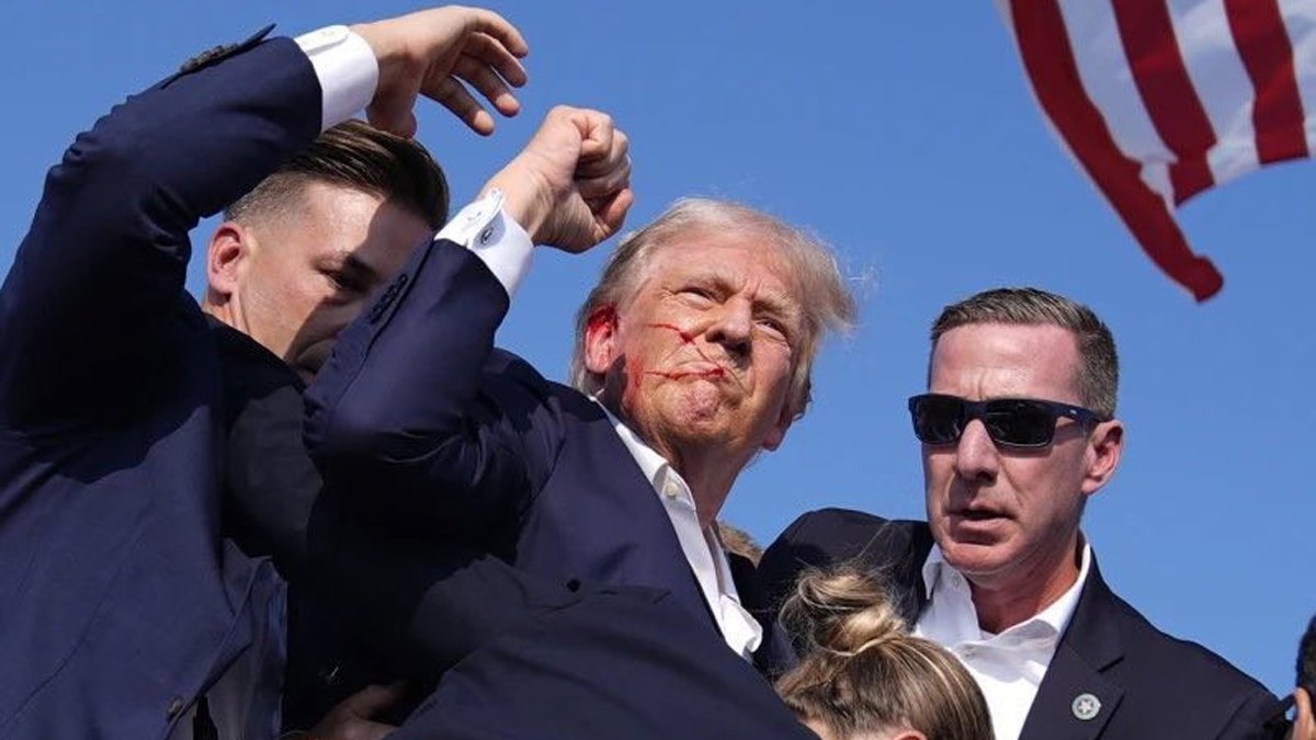 Suikasta uğrayan Trump'ın sağlık durumu nasıl?