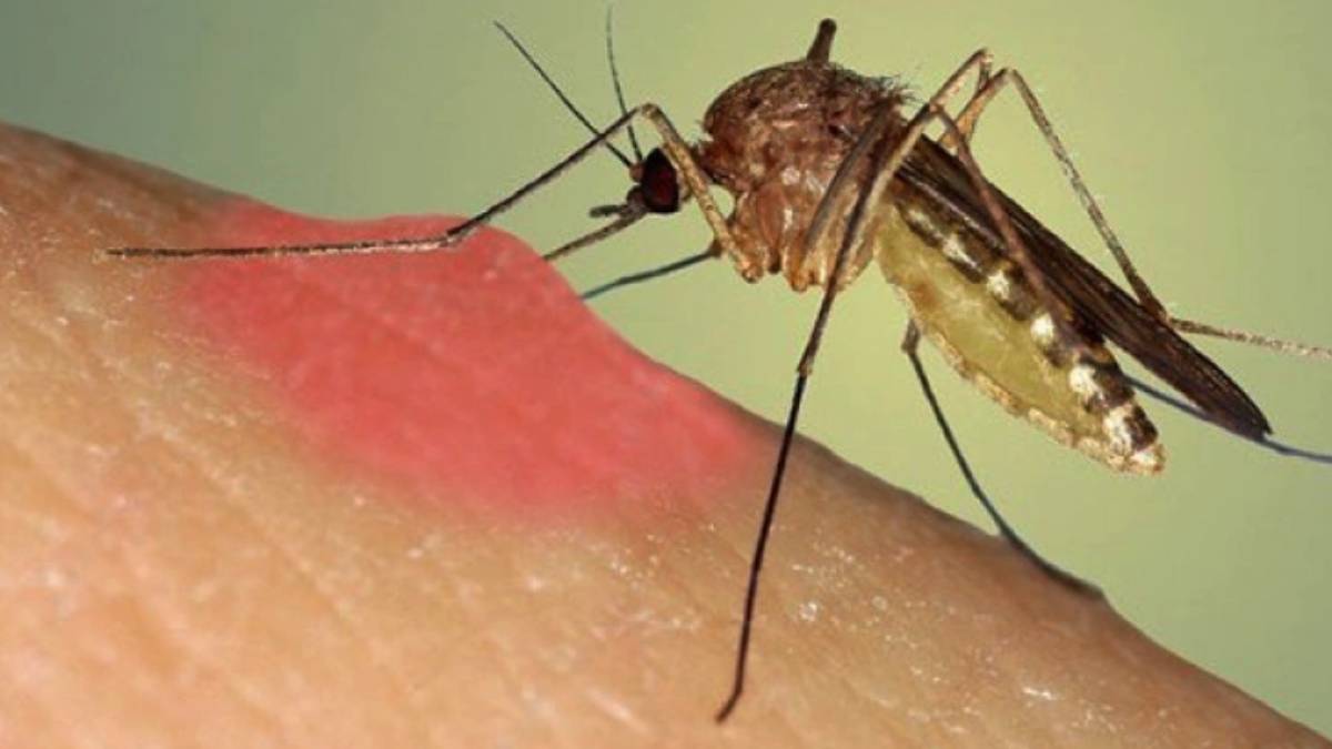 Uzman isimden dikkat çeken uyarı: Sivrisinek ısırığına yoğurt sürmek, ikincil enfeksiyon sebebi