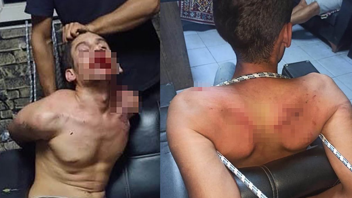 Akılalmaz işkence! Dişlerini kerpetenle çekip hamam böceği yedirdiler