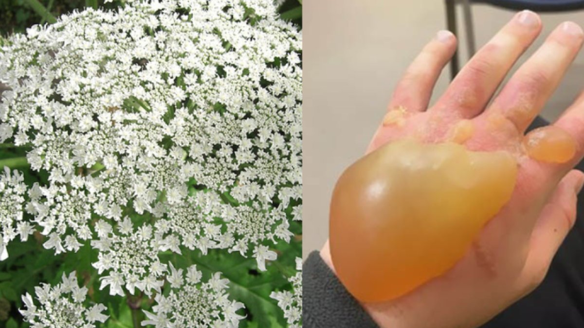 Dünyanın en tehlikeli bitkisi! Dokunanın eli balon gibi şişiyor: Türkiye'de bolca var