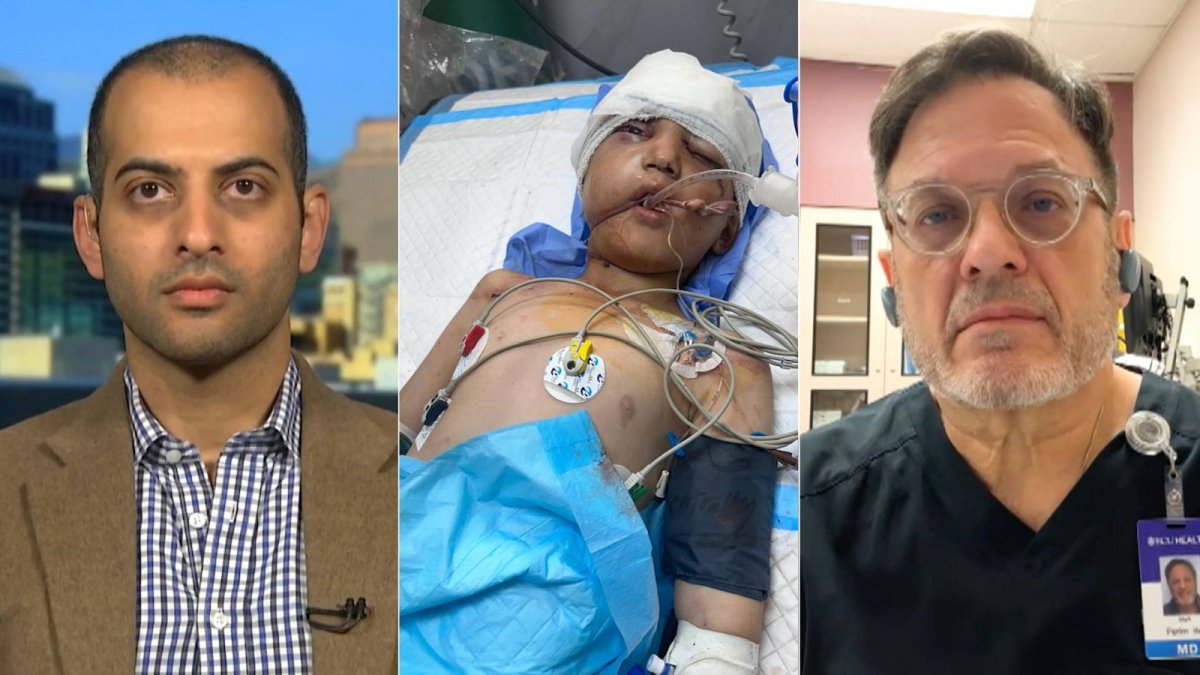 ABD'li cerrahlar dehşeti anlattı: Gazze'de çocuklar için umut kalmadı